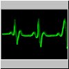 3-D_EKG.gif