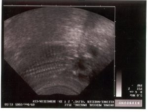 ultrasound_12_9.jpg
