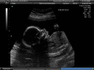 BABY_5.JPG
