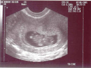 first_ultrasound.jpg